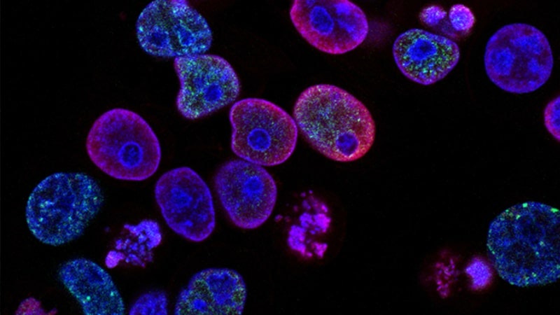Hoy es el Día Mundial de la Lucha contra el Cáncer